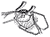 eye surgery