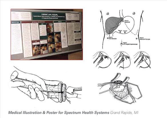 Medical Illustration & Poster for Spectrum Health Systems